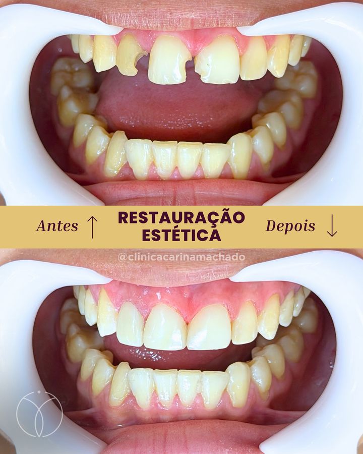 Antes e depois: Restauração estética